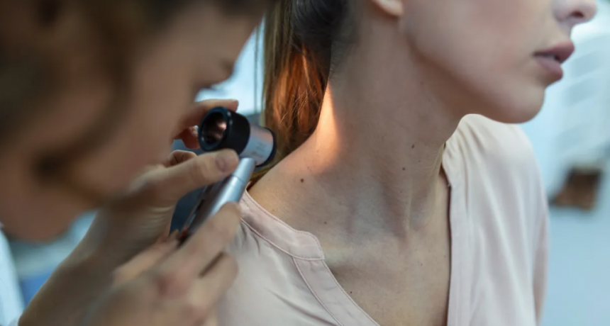Vacuna para el melanoma: ya está disponible en Argentina la primera inmunoterapia nacional para cáncer de piel