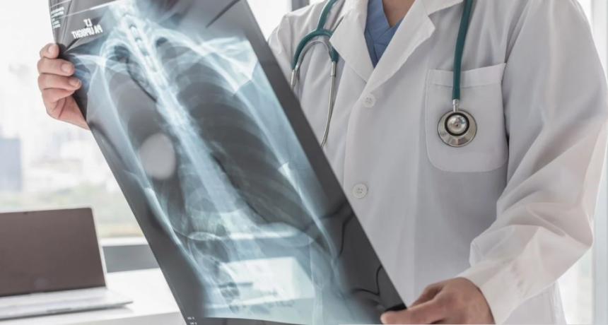 Cómo prevenir el cáncer de pulmón: factores de riesgo y hábitos saludables