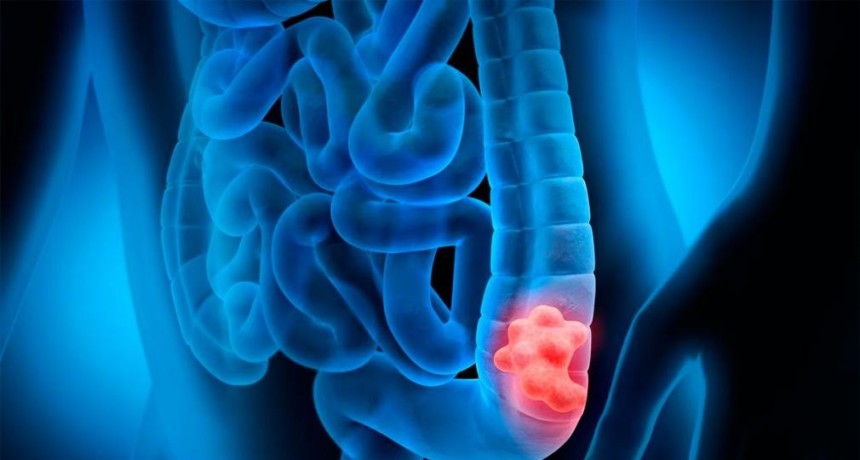 Se aprobó y está disponible en la Argentina un nuevo fármaco para dos tipos de tumores