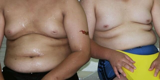 Con la pandemia se disparó el sobrepeso y la obesidad infantil