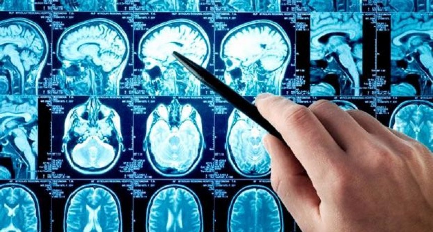 Científicos argentinos del Conicet diseñaron un asistente virtual para reconocer síntomas de ACV